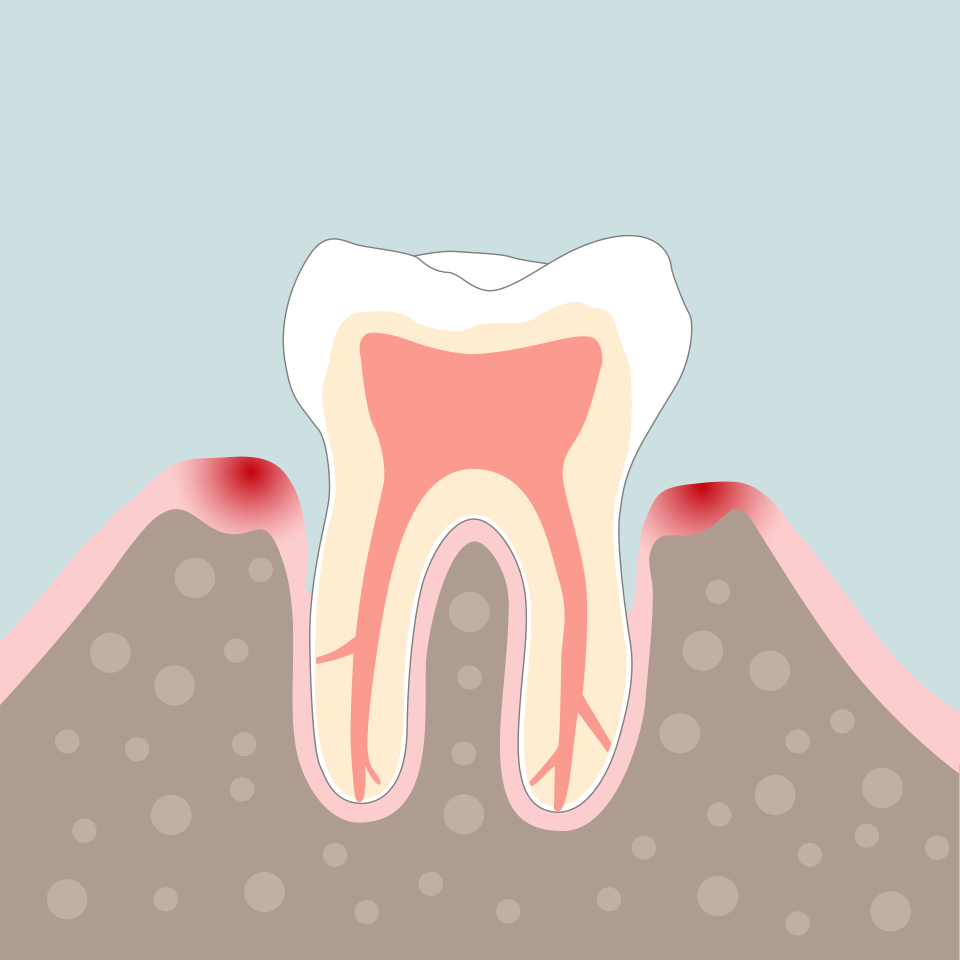 Endodontie Grafik 2