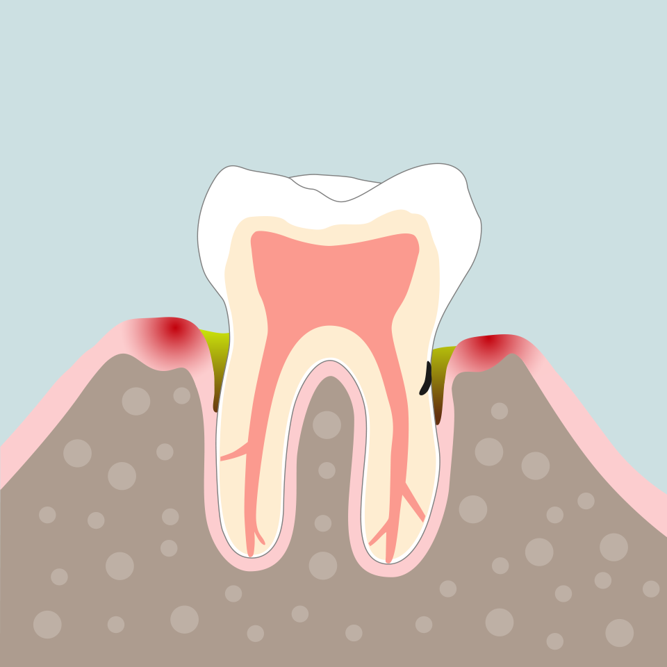 Endodontie Grafik 1