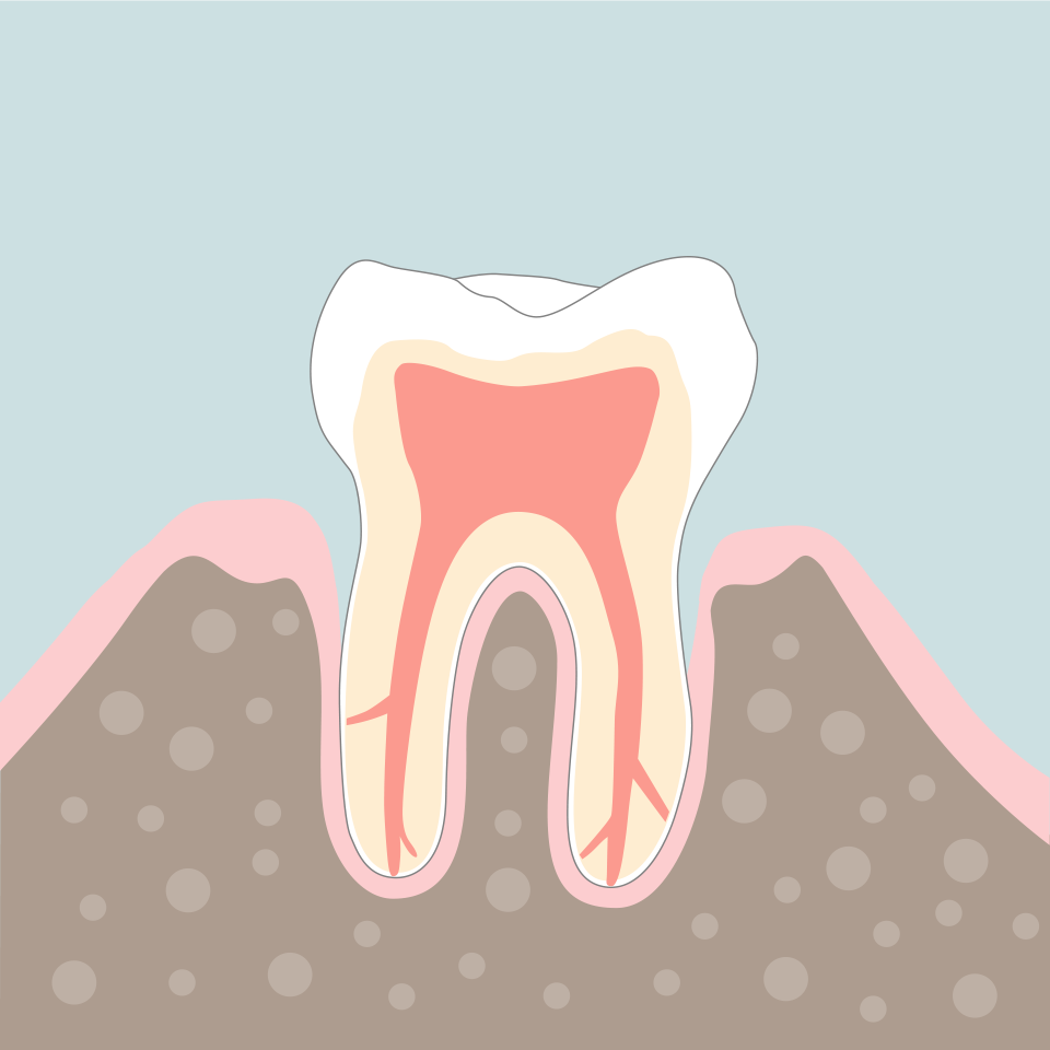 Endodontie Grafik 4