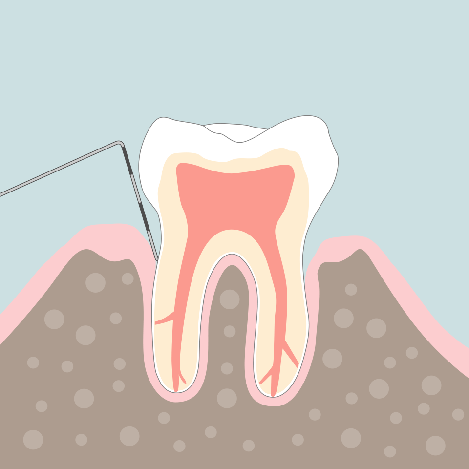 Endodontie Grafik 5
